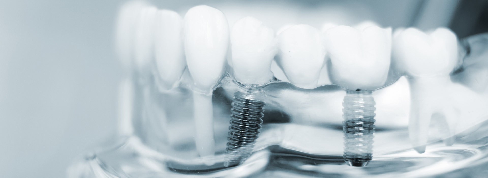 The image displays a close-up of multiple toothbrush bristles against a blurred background.