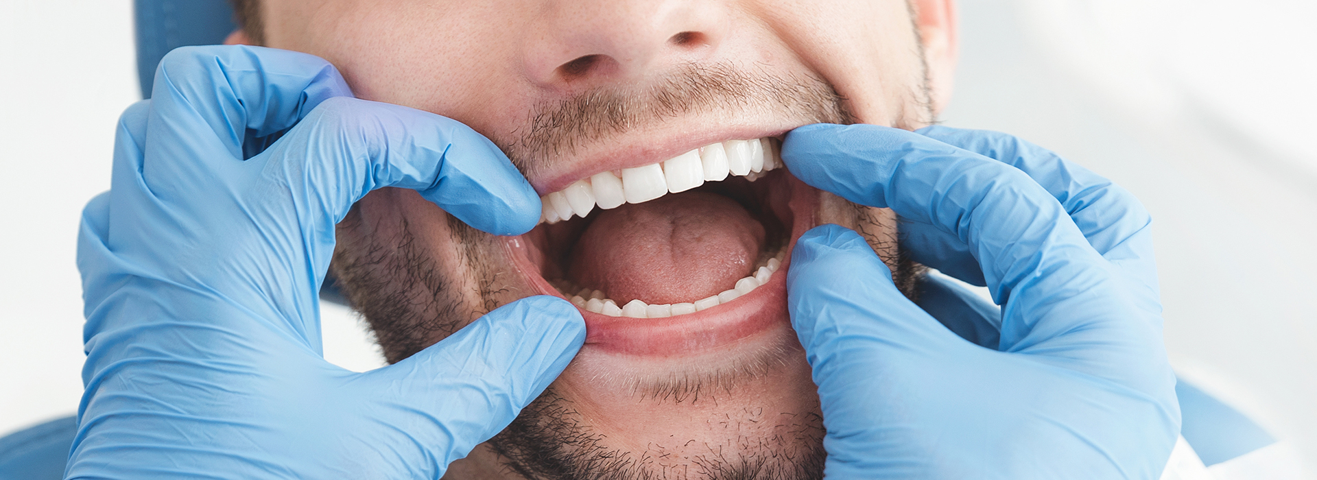 A dental hygienist wearing blue gloves and a face mask, smiling at the camera while holding up a patient s mouth with one hand.